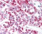GDF15 Antibody (aa30-45)